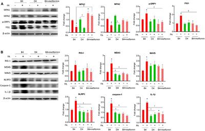 The Causal Role of Mitochondrial Dynamics in Regulating Innate Immunity in Diabetes